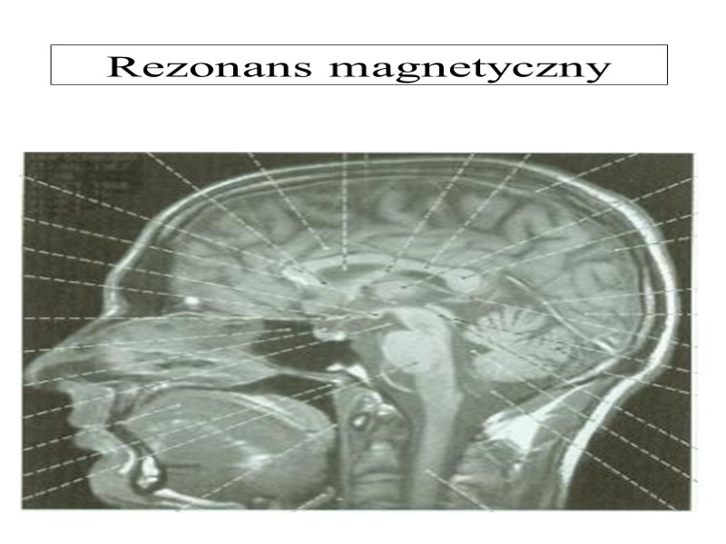 Rezonans magnetyczny